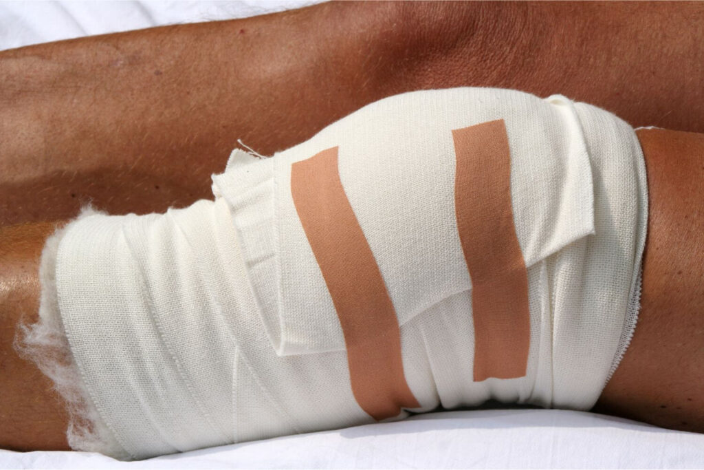 Reparacion-artroscopica-de-meniscos-en-Tijuana