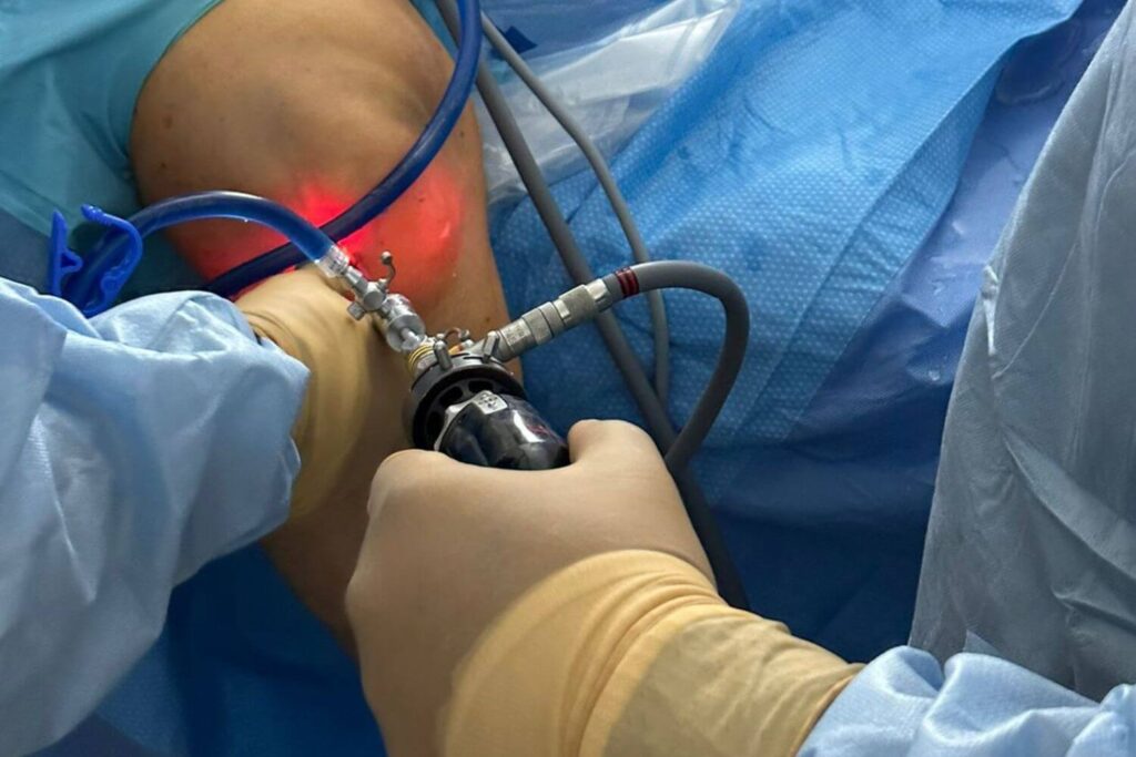 Traumatologia-de-rodilla-en-Tijuana