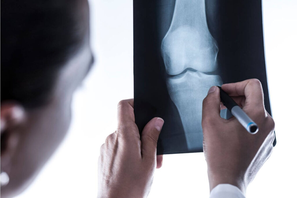 Manejo del dolor de rodilla en Tijuana