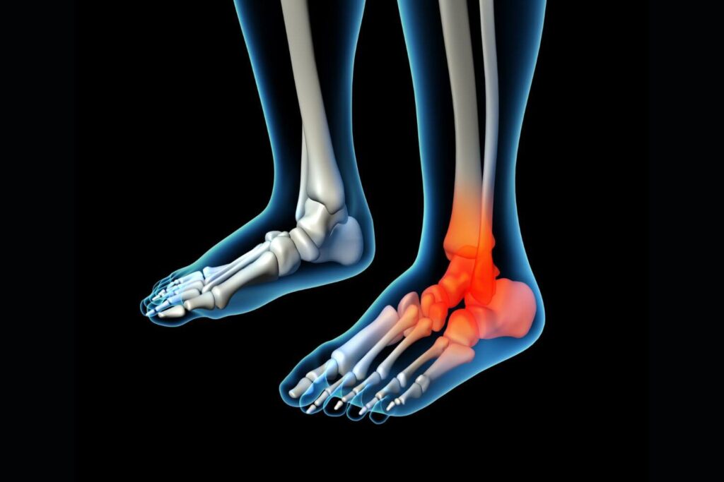 Consulta de traumatología con seguro Monterrey New York Life en Tijuana
